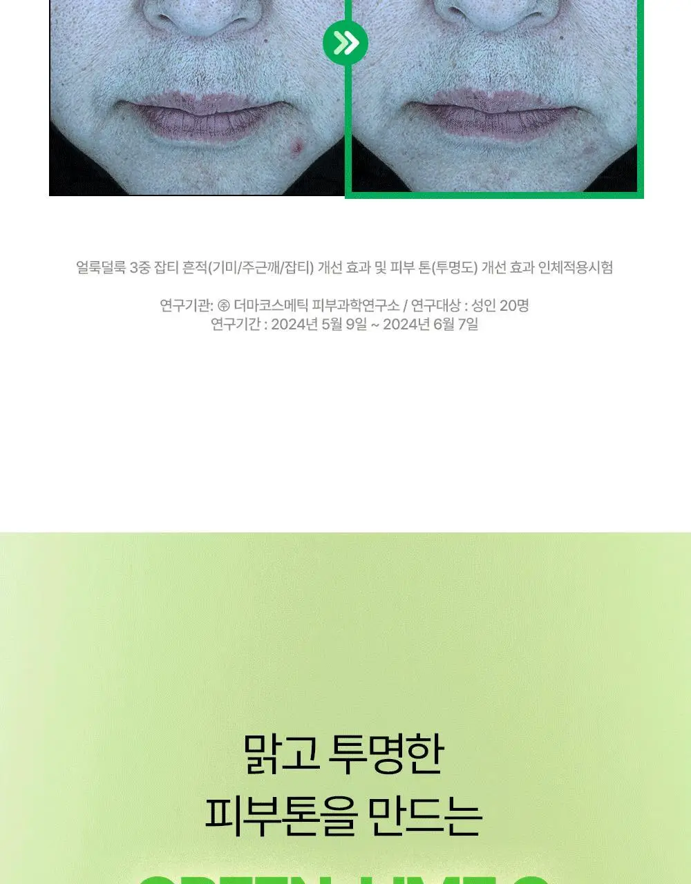 [밀착진정] 듀이트리 AC 딥 진정 마스크 1매 (열감/흔적) 상세페이지 65